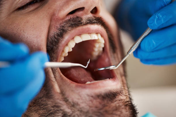 Best Emergency Broken Tooth Repair in Wagoner, OK